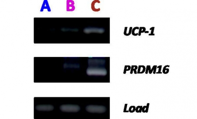 PSdif-BA, Brown Adipocyte Differentiation Kit